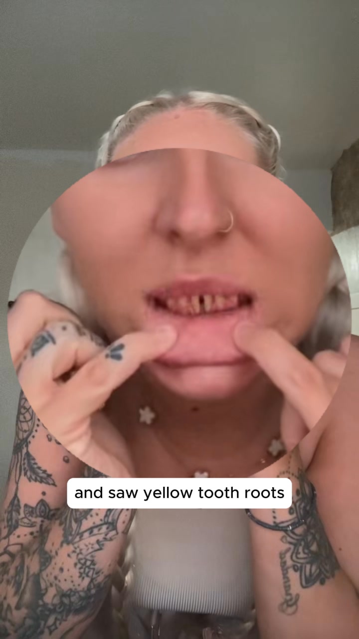 What I Finally Figured Out for My Gums