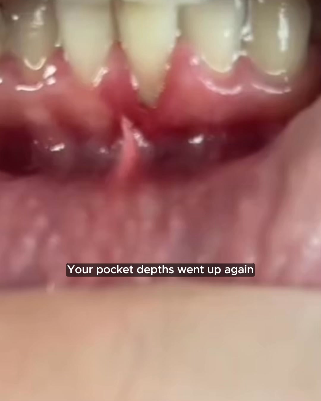 How I solved my gum problems naturally...