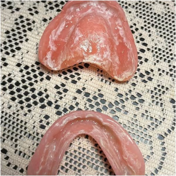 Lees dit als u een kunstgebit draagt