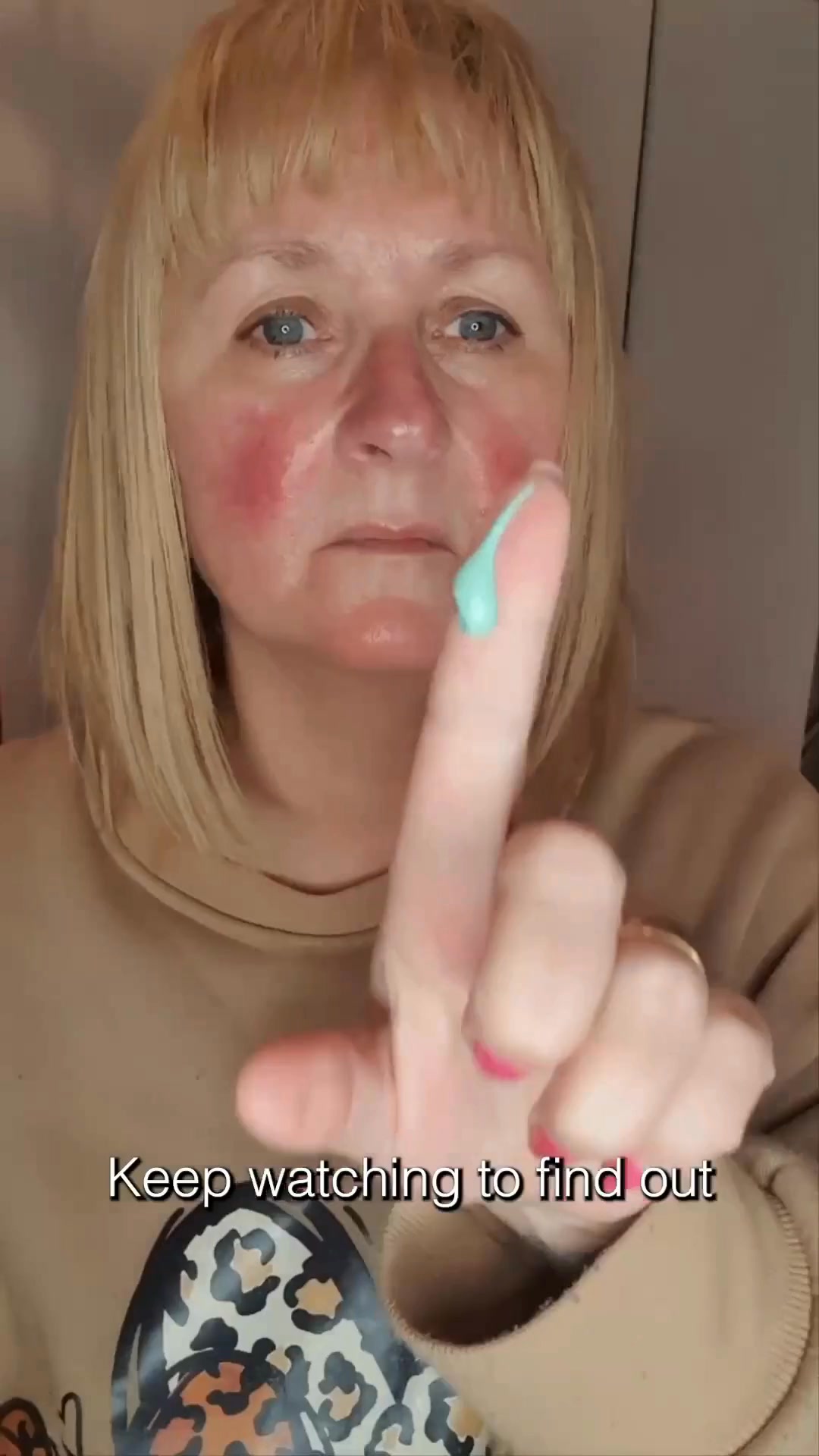 Soothe Rosacea & Redness