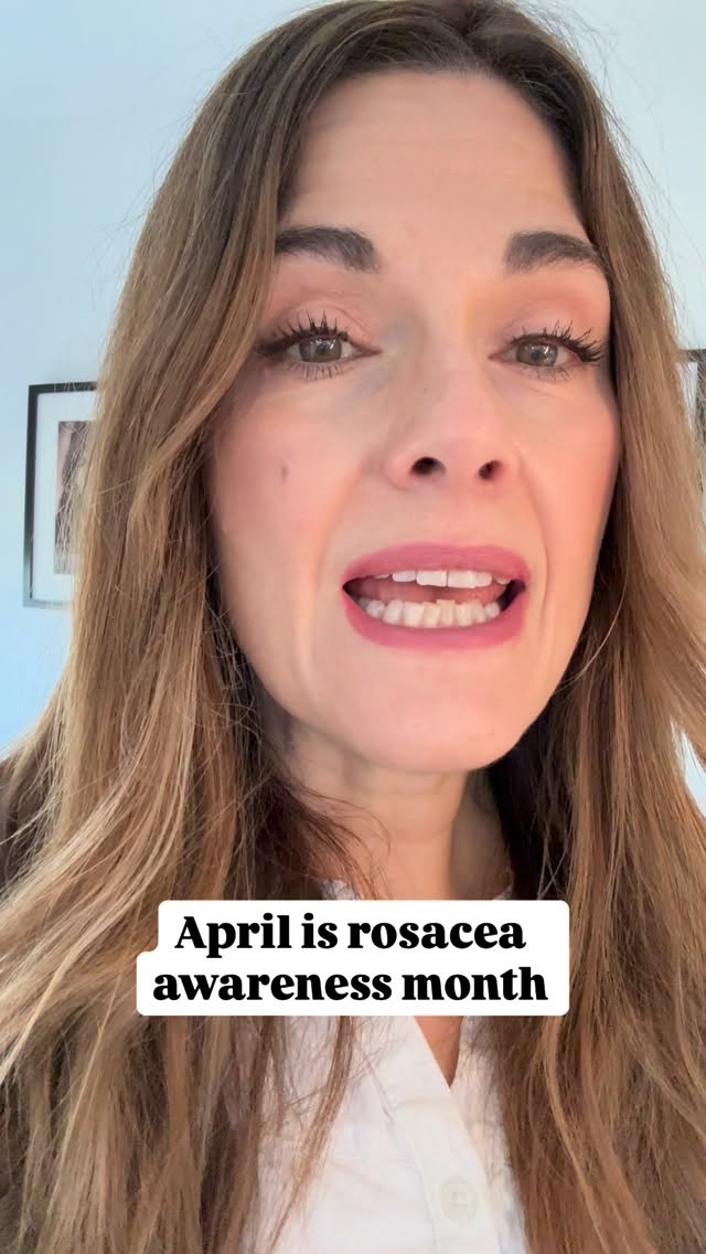 💚 APRIL IS ROSACEA AWARENESS MONTH 💚 

Rosalique are raising awareness by sending out free sample packs so you can try before you buy during April - link in my bio. 

If you already love Rosalique, I can get you 15% discount with my code : VICTROSA15
#rosaliqueskincare #rosacea #rosaceaawarenessmonth