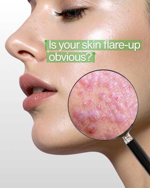 BodyWash for Eczema & More