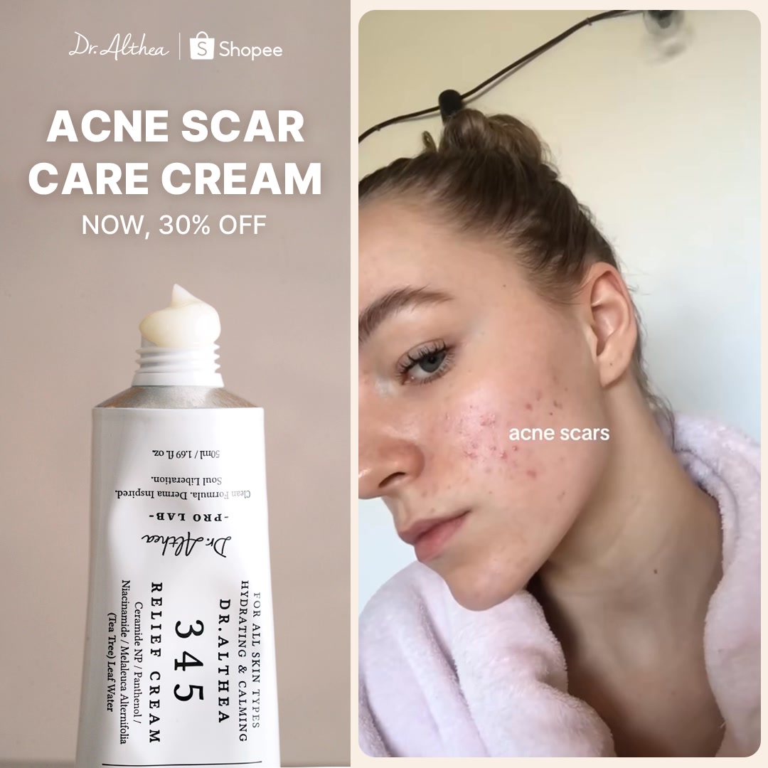 ❤️Get 30% OFF and start your acne scar care❤️