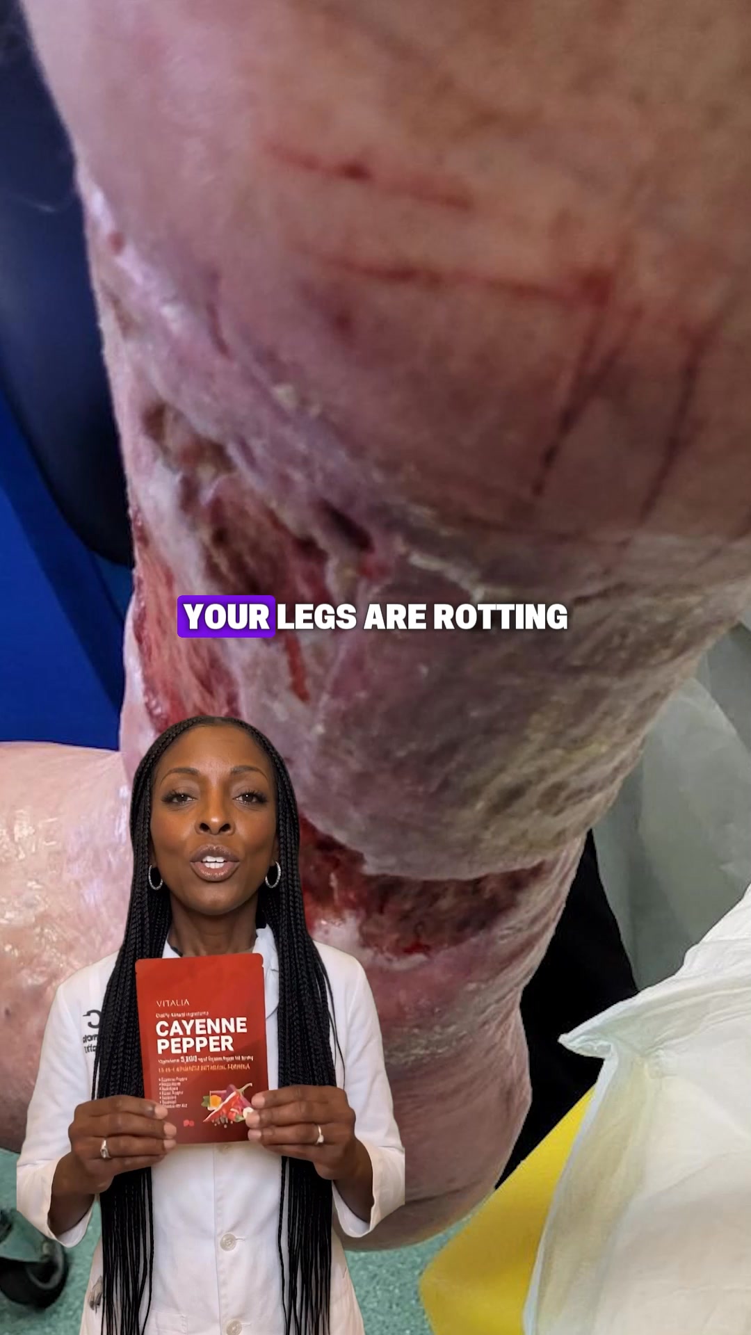 Restore your circulation naturally