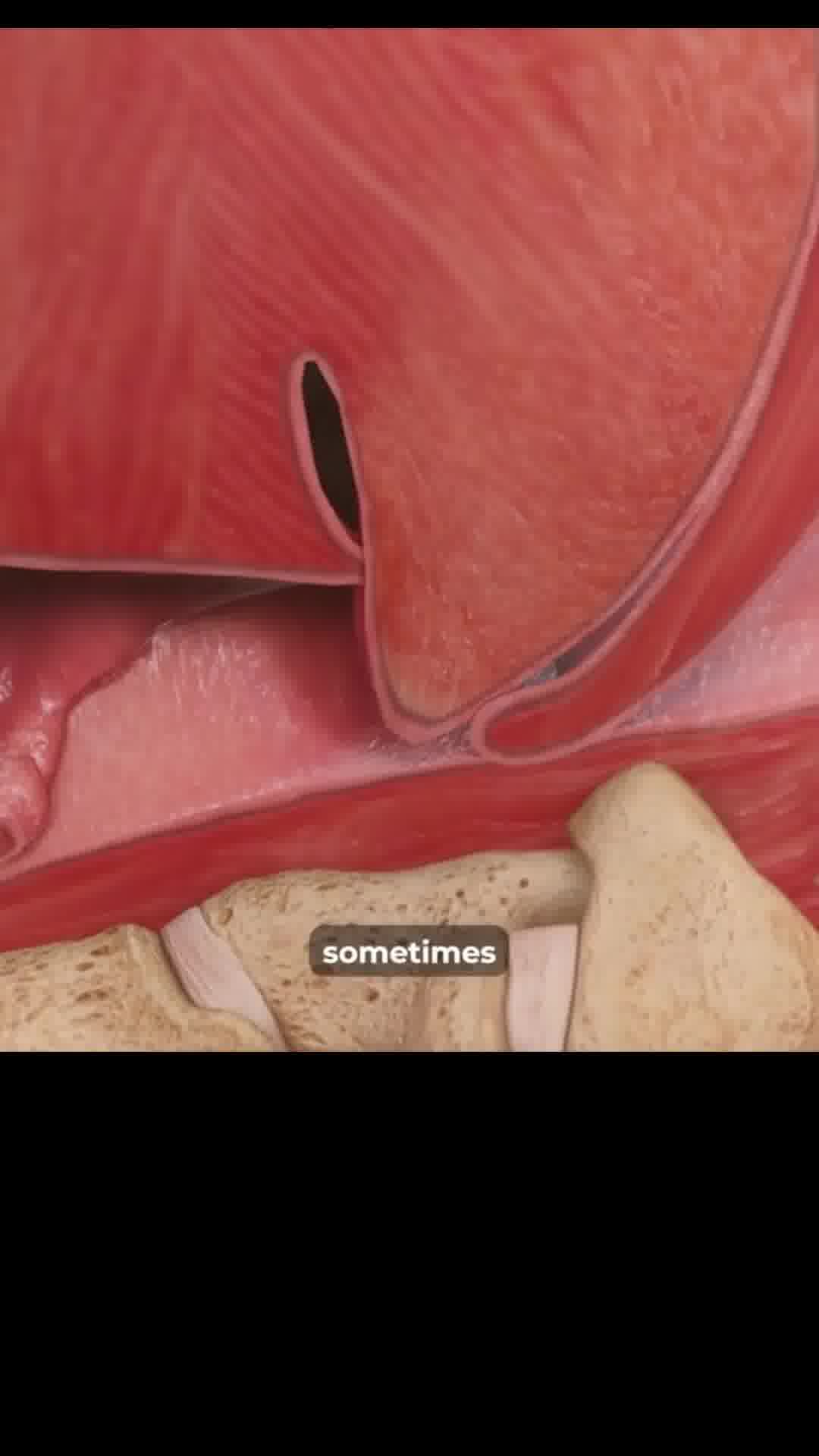 The Silencer For The Snoring