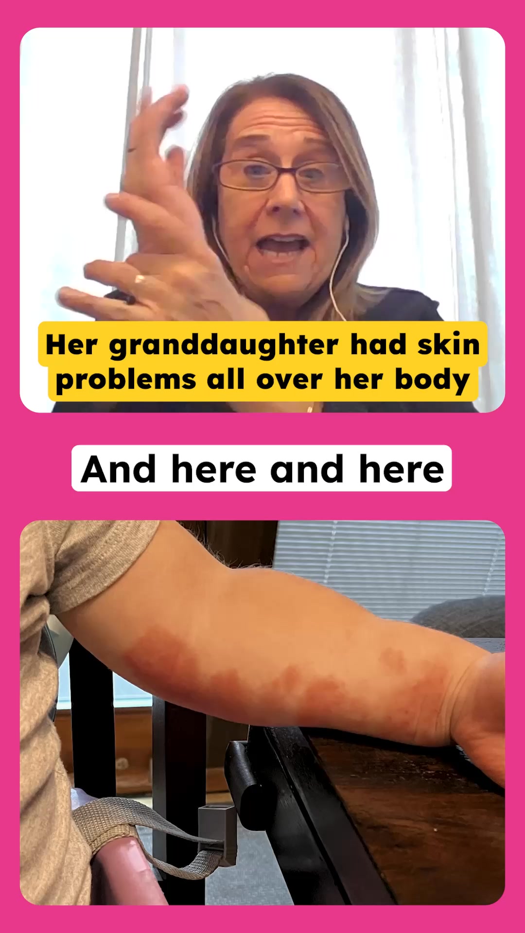 Clearer, Healthier Skin for Kids