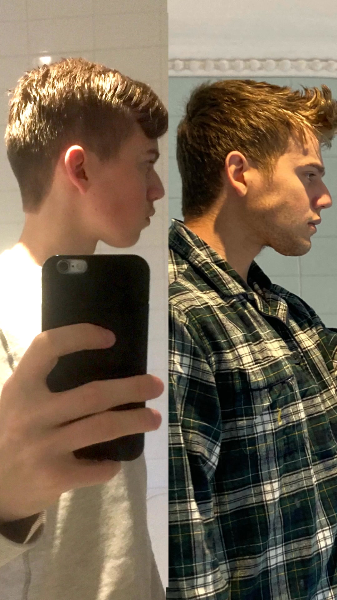 Mejorando la estructura facial