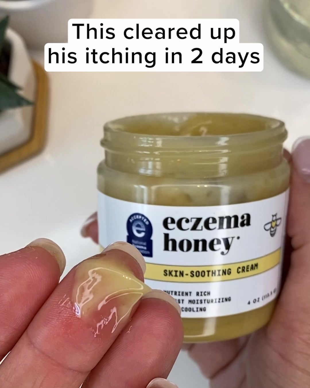 Effective Eczema Relief for Children