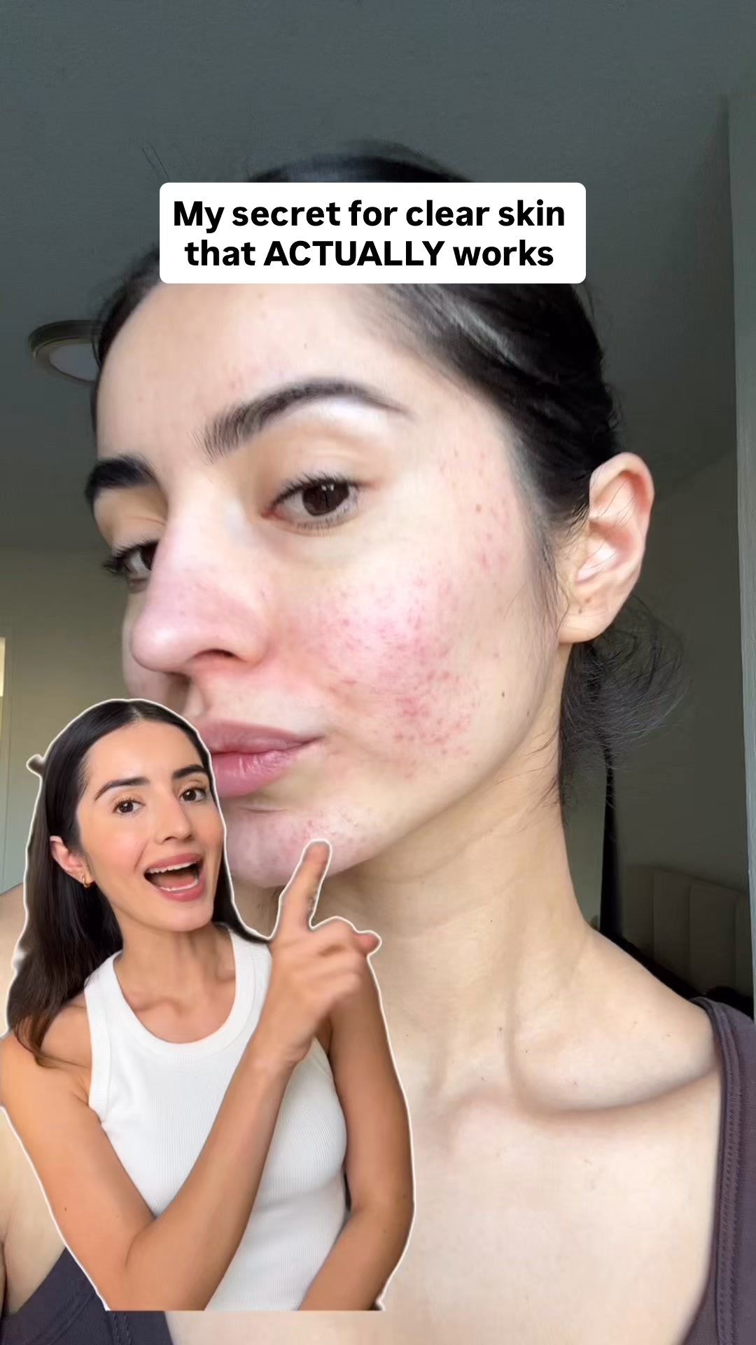 10 Days to Smooth, Ageless Skin