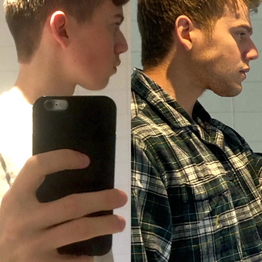 De meest effectieve kaaktrainer