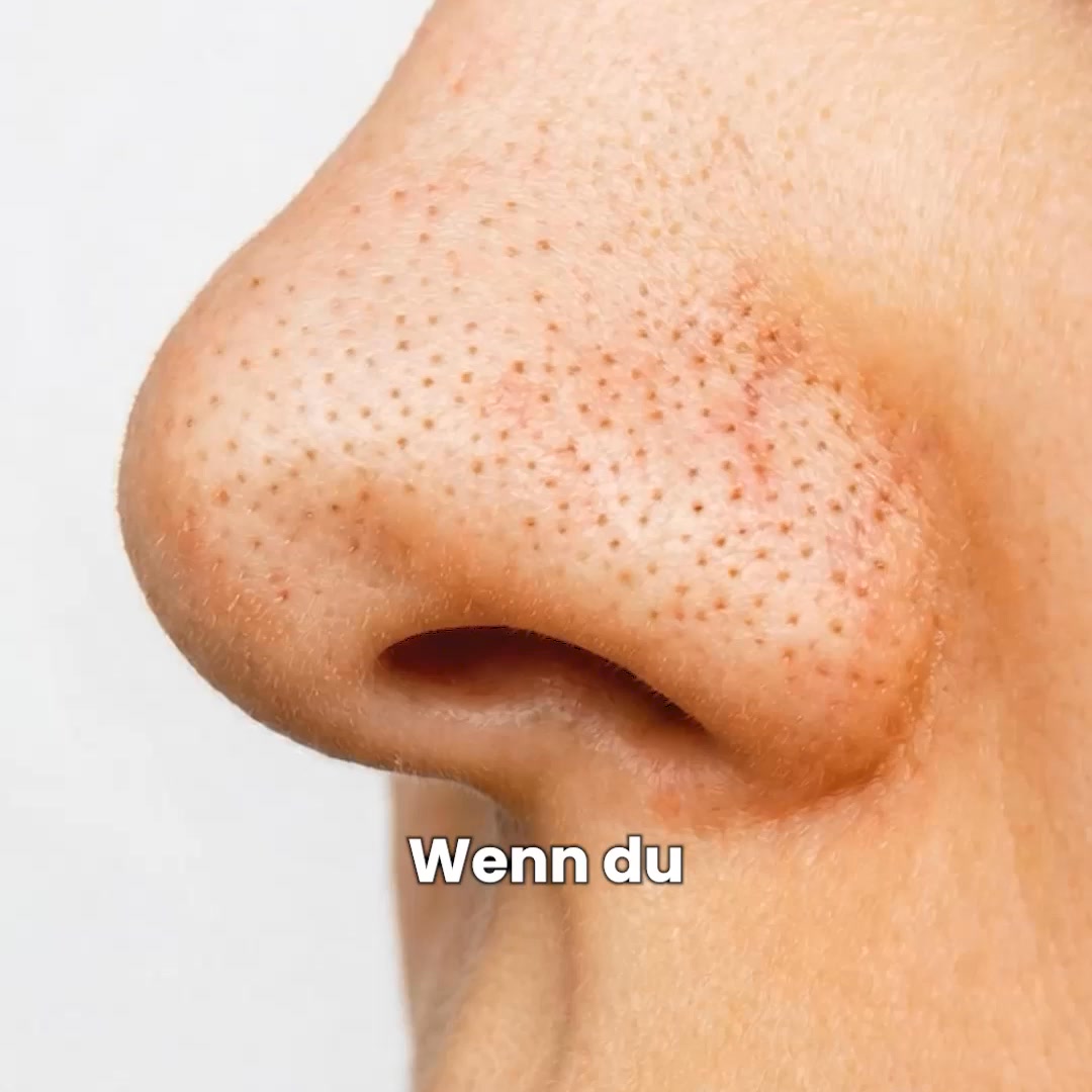 Jetzt bei Rossmann erhältlich