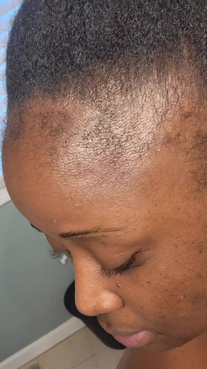 Tired of Watching Your Hair Disappear? This Changes Everything.