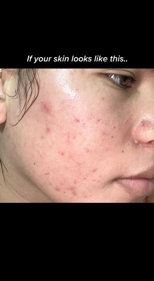 Repair you skin barrier with PINK ALOE 🎀