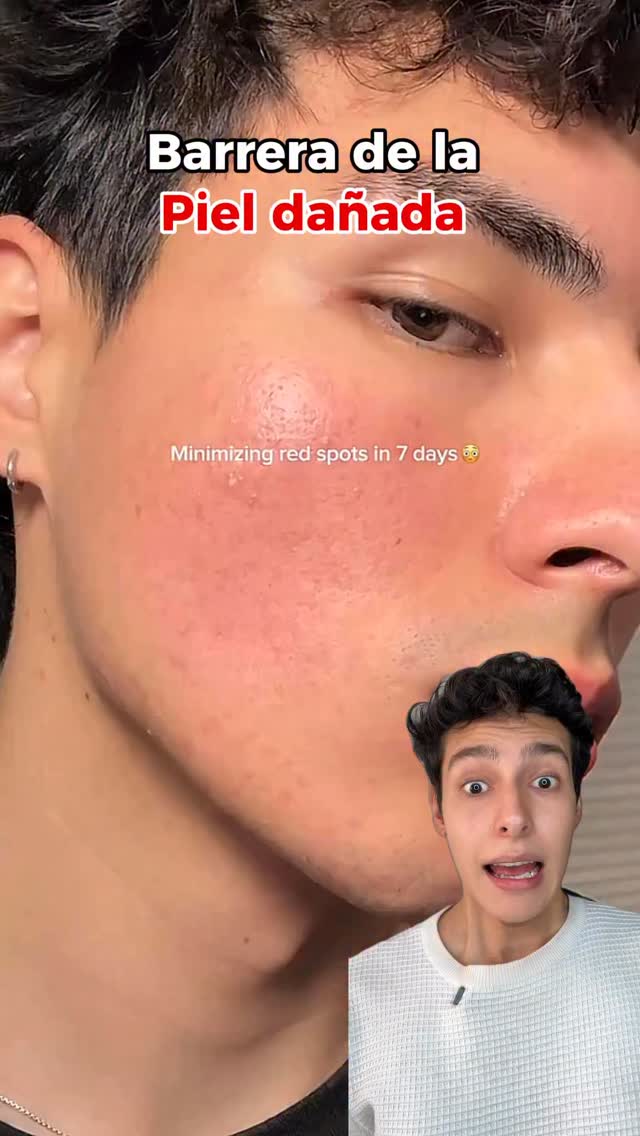 Sígueme para más tips ❤️ 
Esta Abib Ectoin Cream es literalmente una 🩹 para tu piel.
La ectoína protege y fortalece la barrera cutánea, mientras el pantenol calma, hidrata y ayuda a reparar la piel irritada y enrojecida.
Ideal cuando tu piel está sensible, reactiva o dañada 💙

@abib.global 

#abibcream #skinbarrier #ectoína #pantenol #enrojecimiento