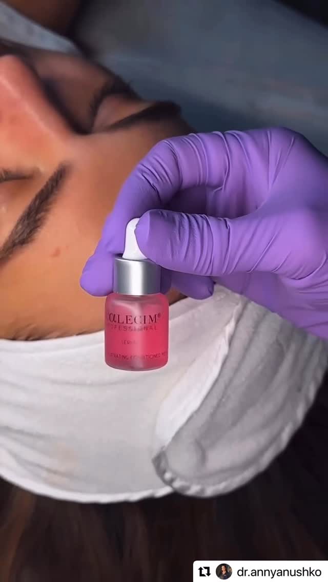 As seen @dr.annyanushko , one of the best ways to use PTT-6®️ technology. Microneedling preps the skin in two ways to absorb these active stem cell proteins. 

- by creating micro channels for the product to absorb deeper into the skin 
- ⁠by creating micro injuries so that skin is activated to repair and renew. The PTT-6®️ then kicks in to amp up this repair activity 

The results? Not just glass skin with smoother texture. Enjoy firmer, more supple and taut skin with bounce and radiance. 

Try it with your next clinical treatment. Or even at home. For next level youthful skin.

#CALECIM #CALECIMprofessional #skincaregoals #beautifulskin #beforeandafter #skincare #stemcell #pamperyourskin #skinlove #hydratedskin #beautyday #takecareofyourskin #wellness #cleanskin #skincareaddict #wellnesswednesday #feelgood #realwomenrealresults #realwomen #makeover #facial #skincareroutine #instabeauty #instaderm #dailyskincare
