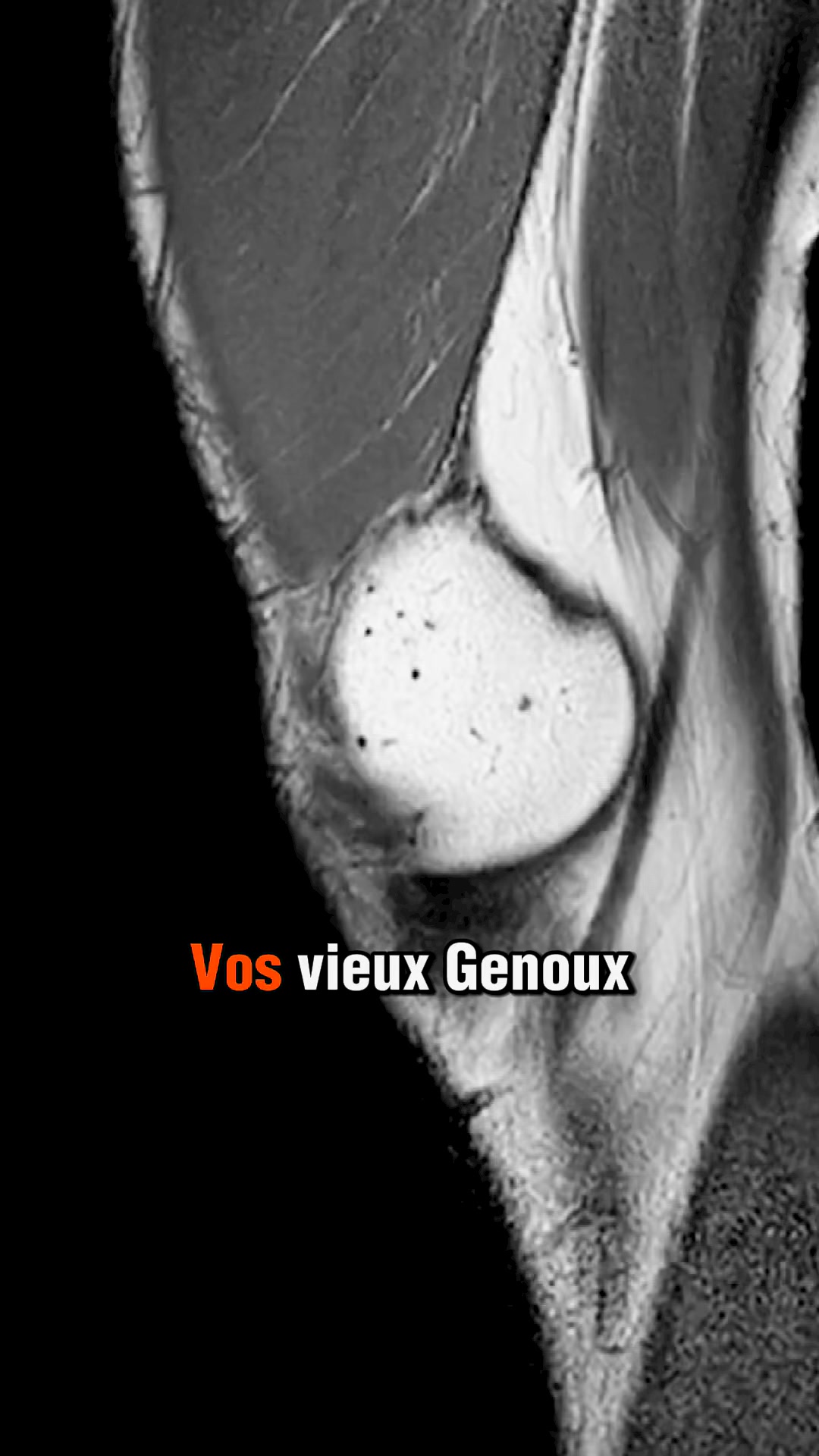 Soulage et protège les genoux