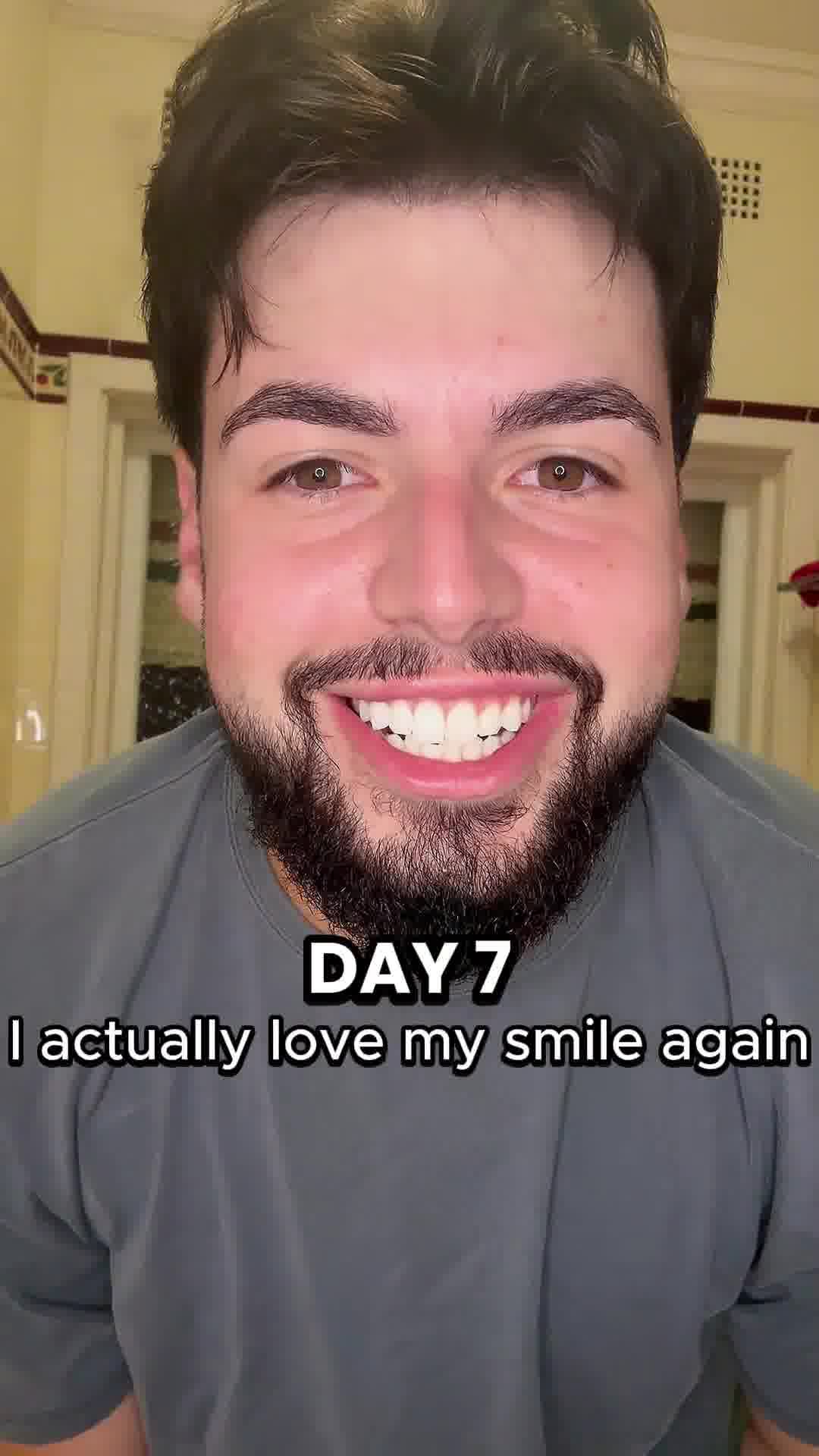 Dentist-Quality Whitening