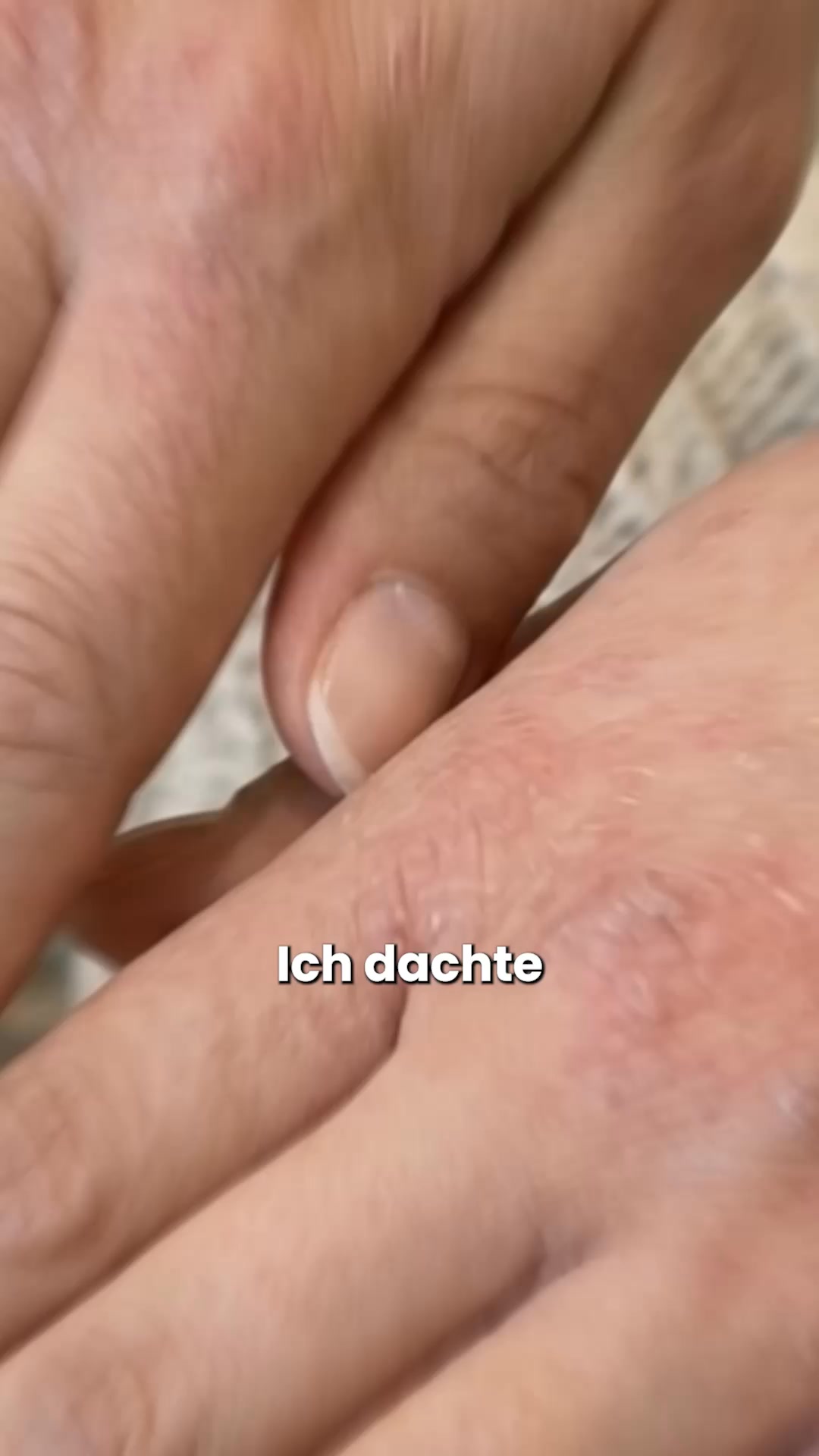 Sofortige Linderung für deine Haut! 💧