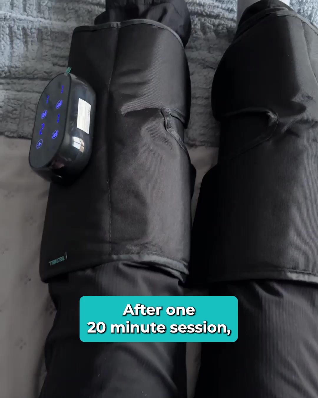 Swollen legs for 4 years. Gone in 20 minutes