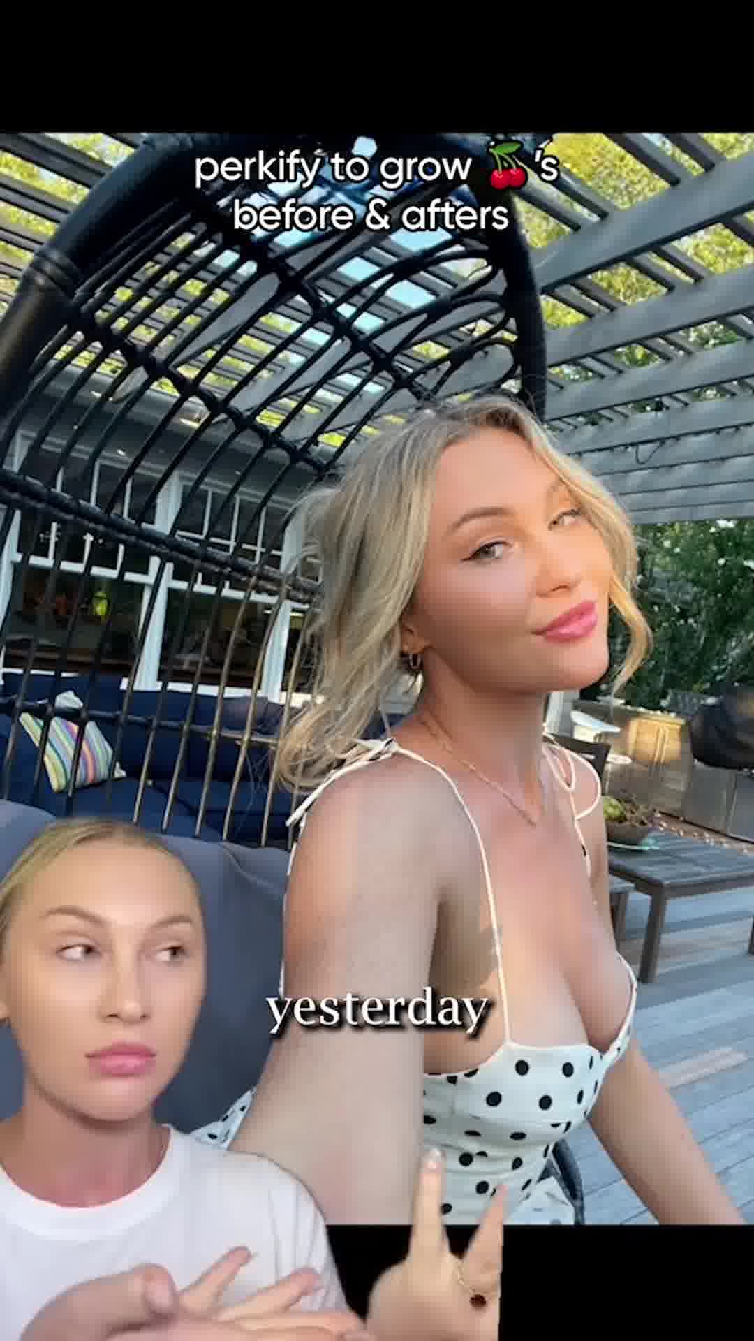 Try Perkify once before costly surgeries!