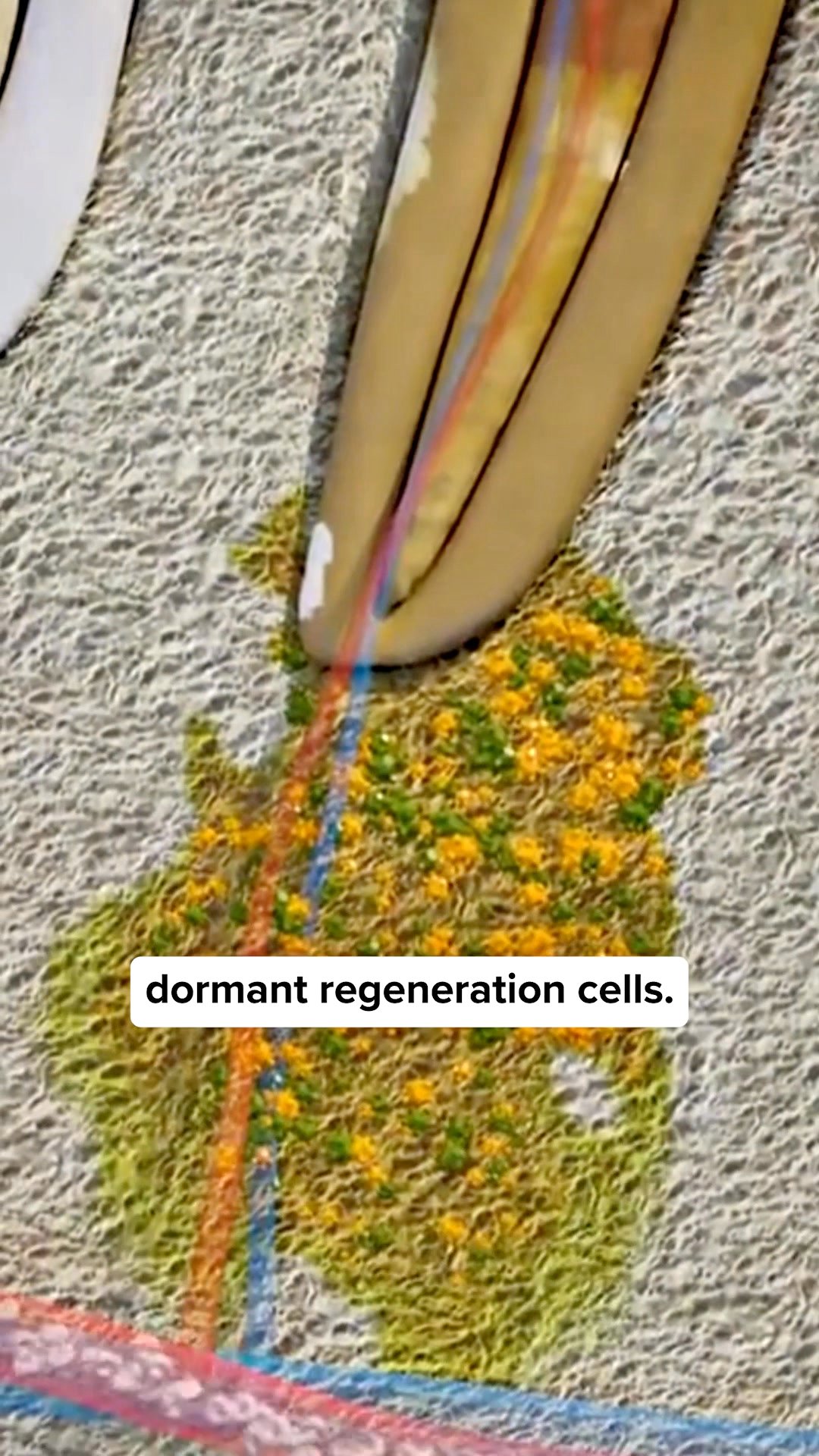 How my gums started to regrow within days...