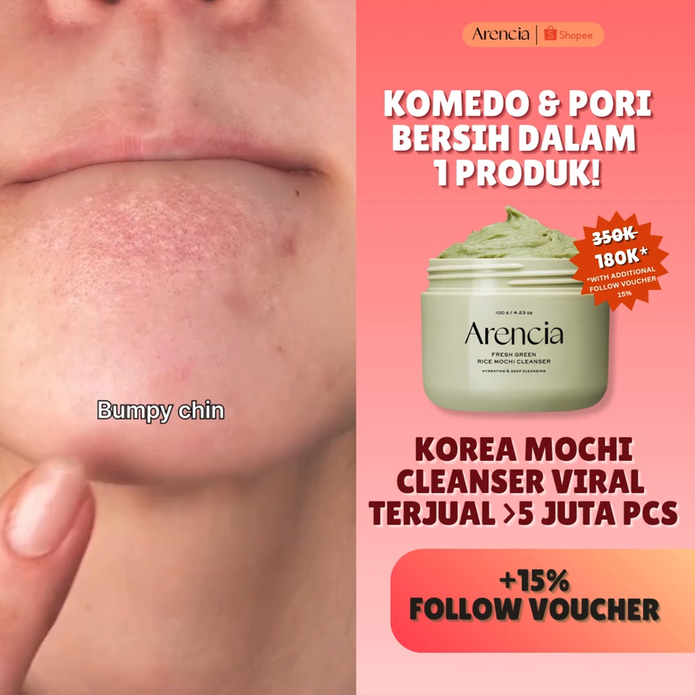 ✨DISKON SETIAP HARI✨