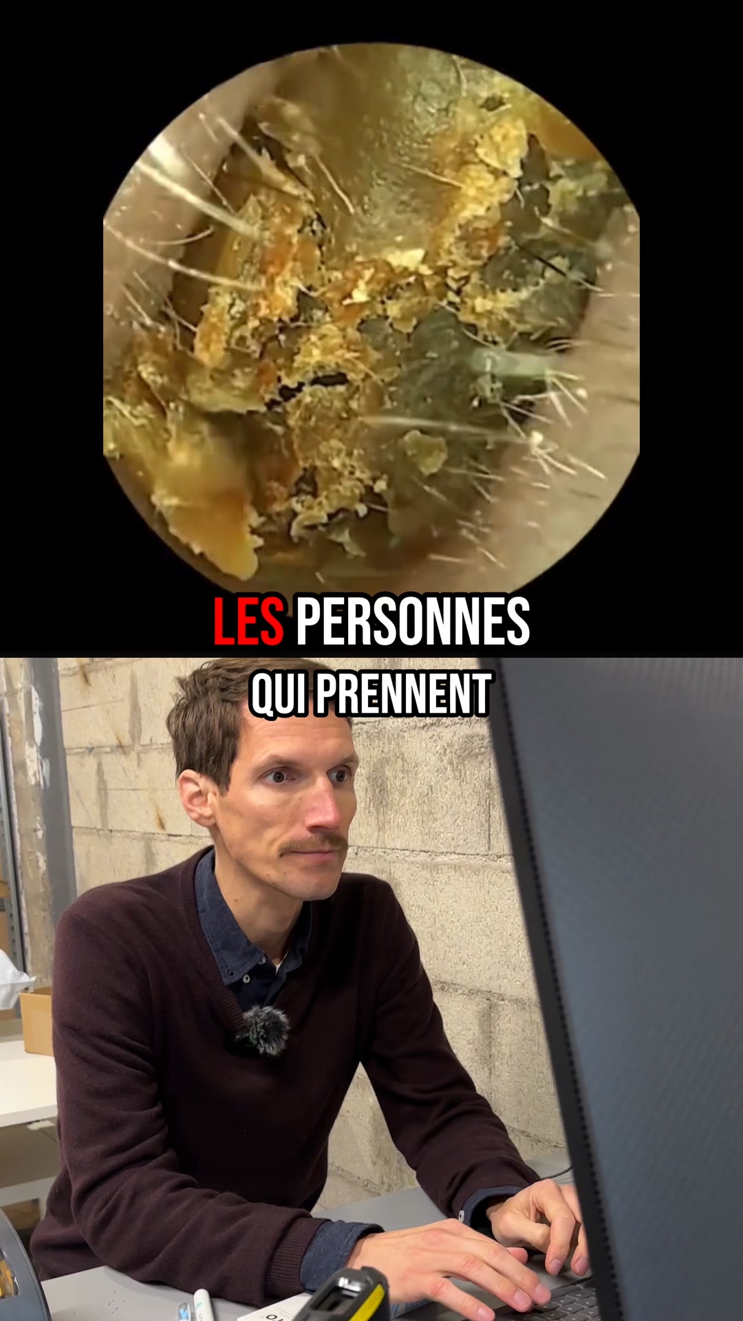👀 Voyez ce qui se cache VRAIMENT dans vos oreilles