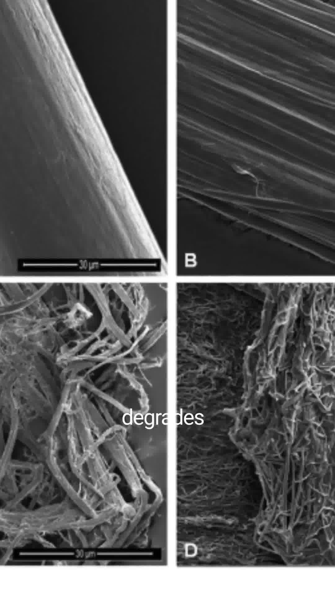 Tired of Eye Floaters?