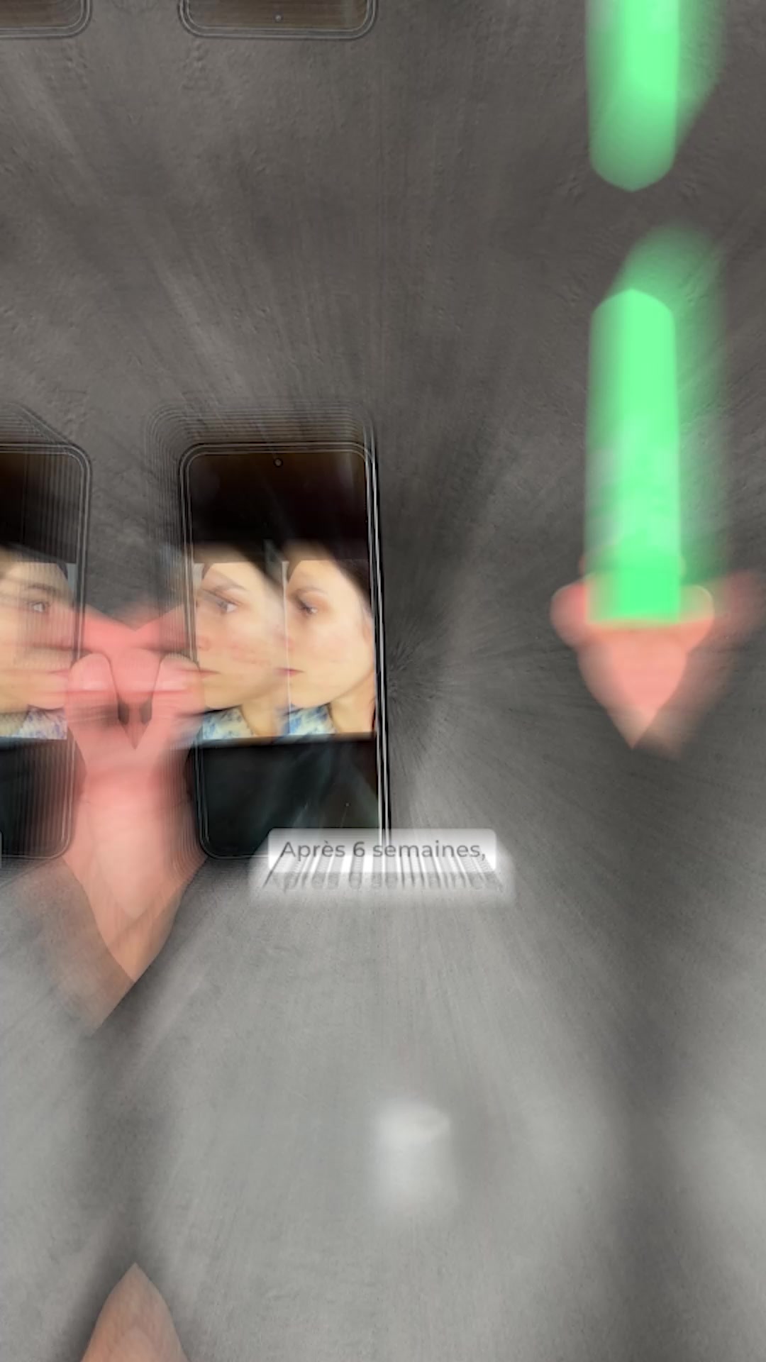 Nouveauté : Anti-Imperfections