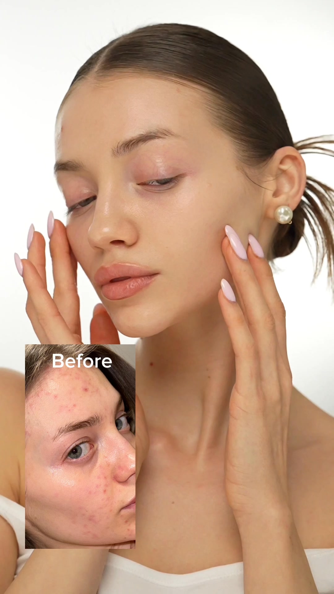 Gentle power for your delicate skin 🌿✨🤍 No fragrance, no alcohol, just pure botanical goodness to keep your skin calm and resilient.

Hypoallergenic & Vegan ✔️ Restores skin’s natural balance ✔️ Fast absorption with no stickiness ✔️

Because sensitive skin deserves a routine that’s both kind and effective. Live with wonder, day by day 🤍

· Black Rice Hyaluronic Toner | Gentle hydration for sensitive skin
· Black Rice Probiotics Barrier Essence | Probiotics for a balanced skin microbiome

#haruharuwonder #livewithwonderdaybyday #blackrice