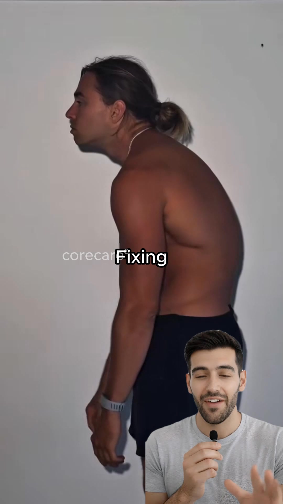 How To Fix Anterior Pelvic Tilt (FOREVER)