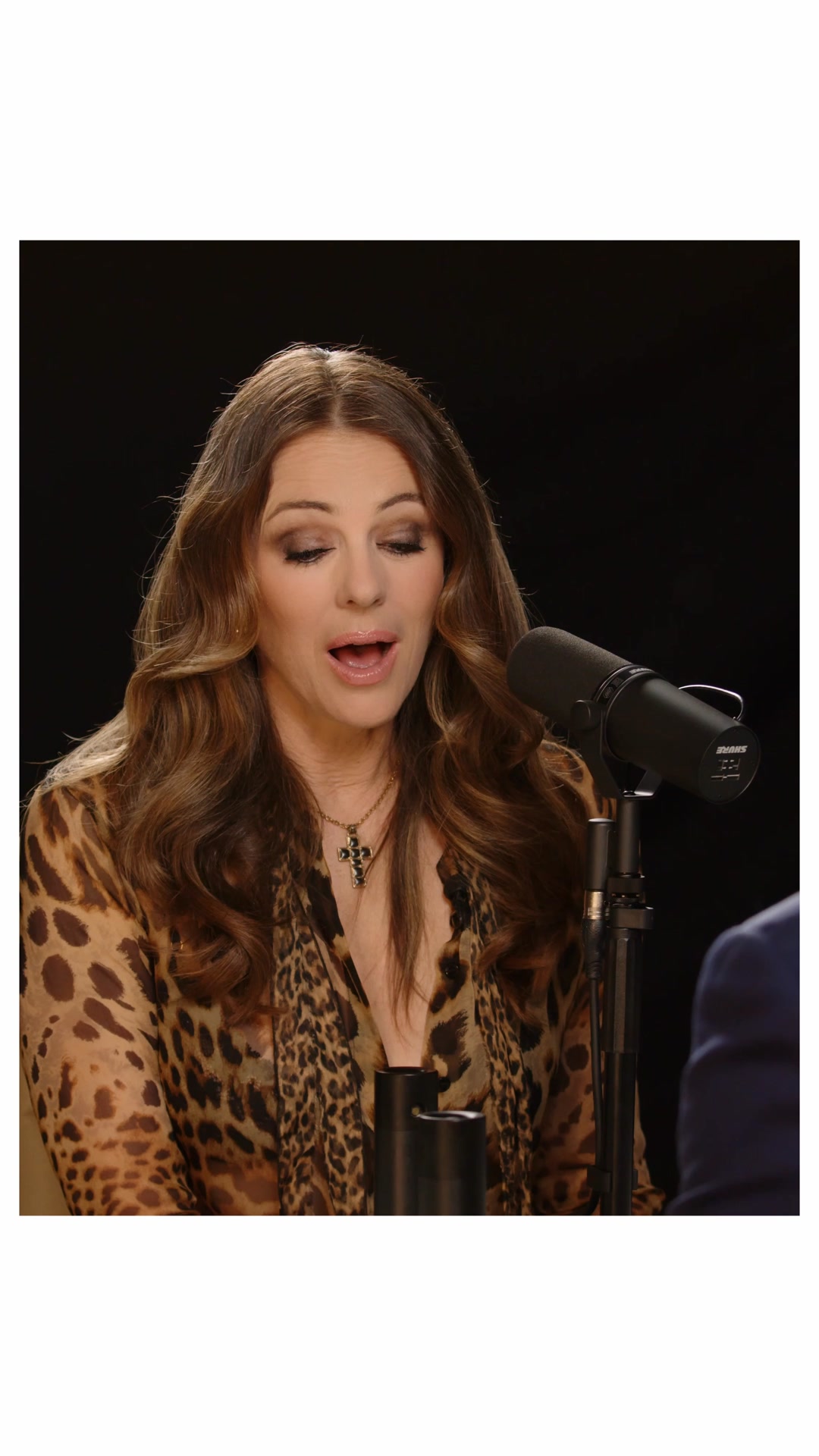 What Changed Elizabeth Hurley’s Skin?