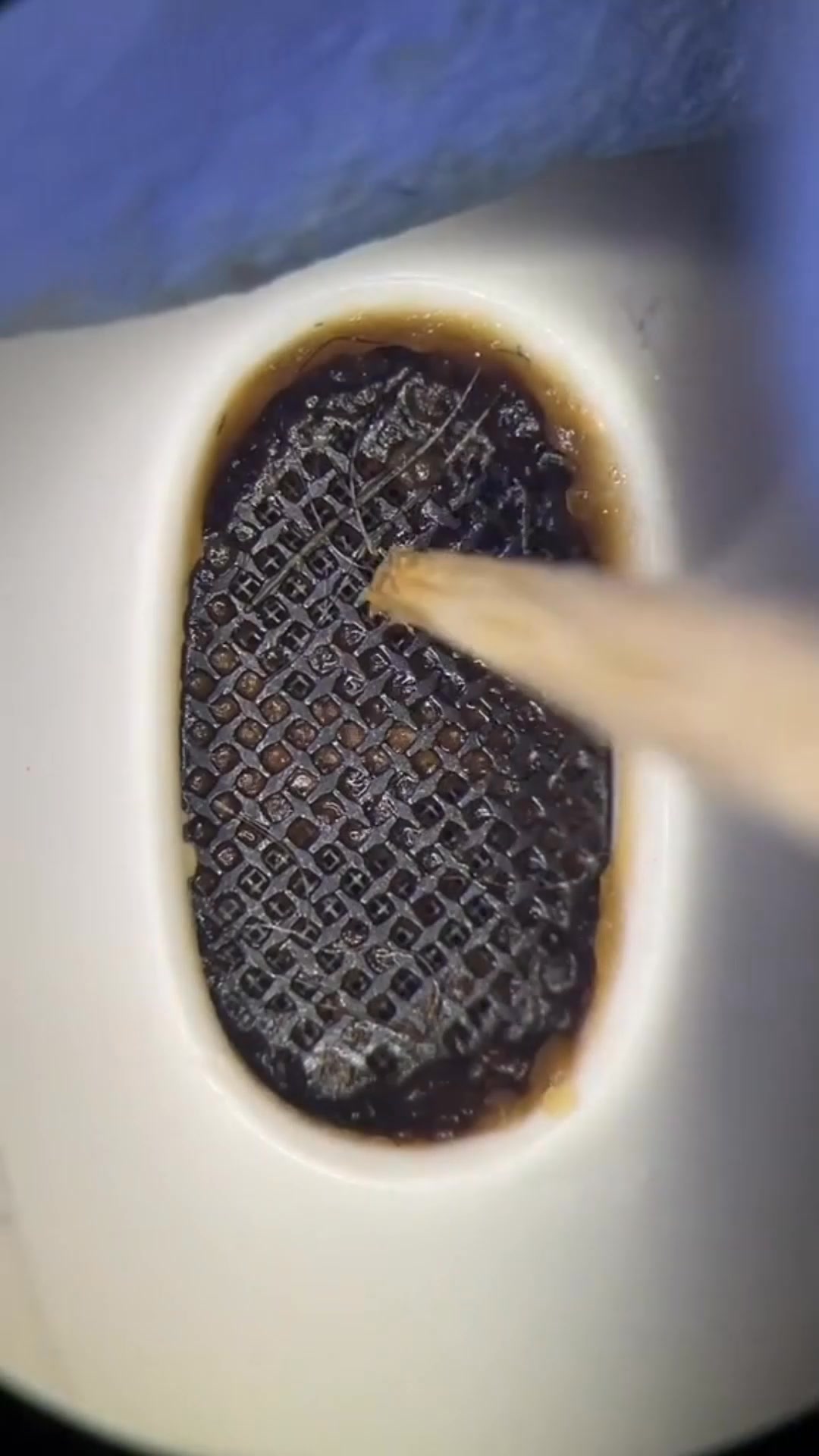 👀 Voyez ce qui se cache VRAIMENT dans vos oreilles