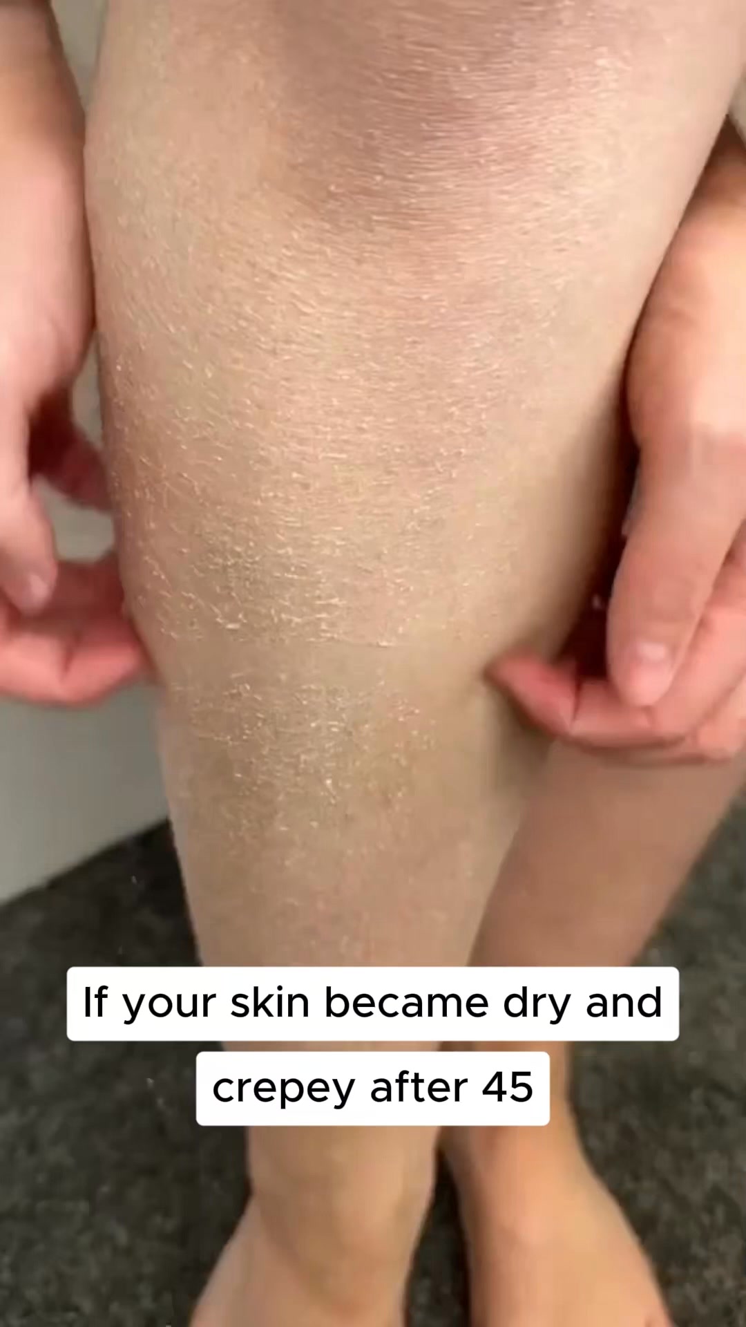 The reason your skin turned crepey.