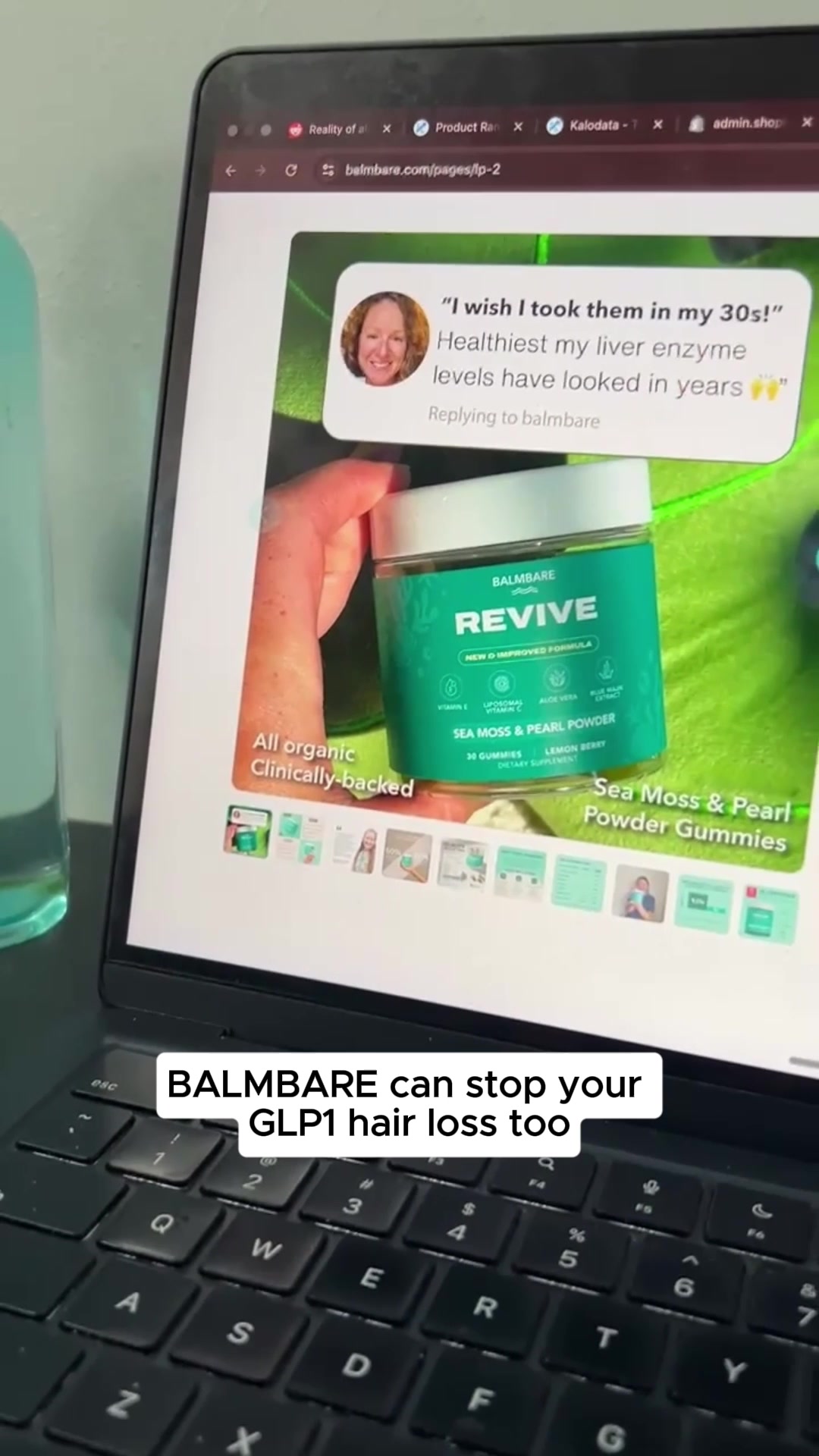 Hair Loss Due to GLP-1