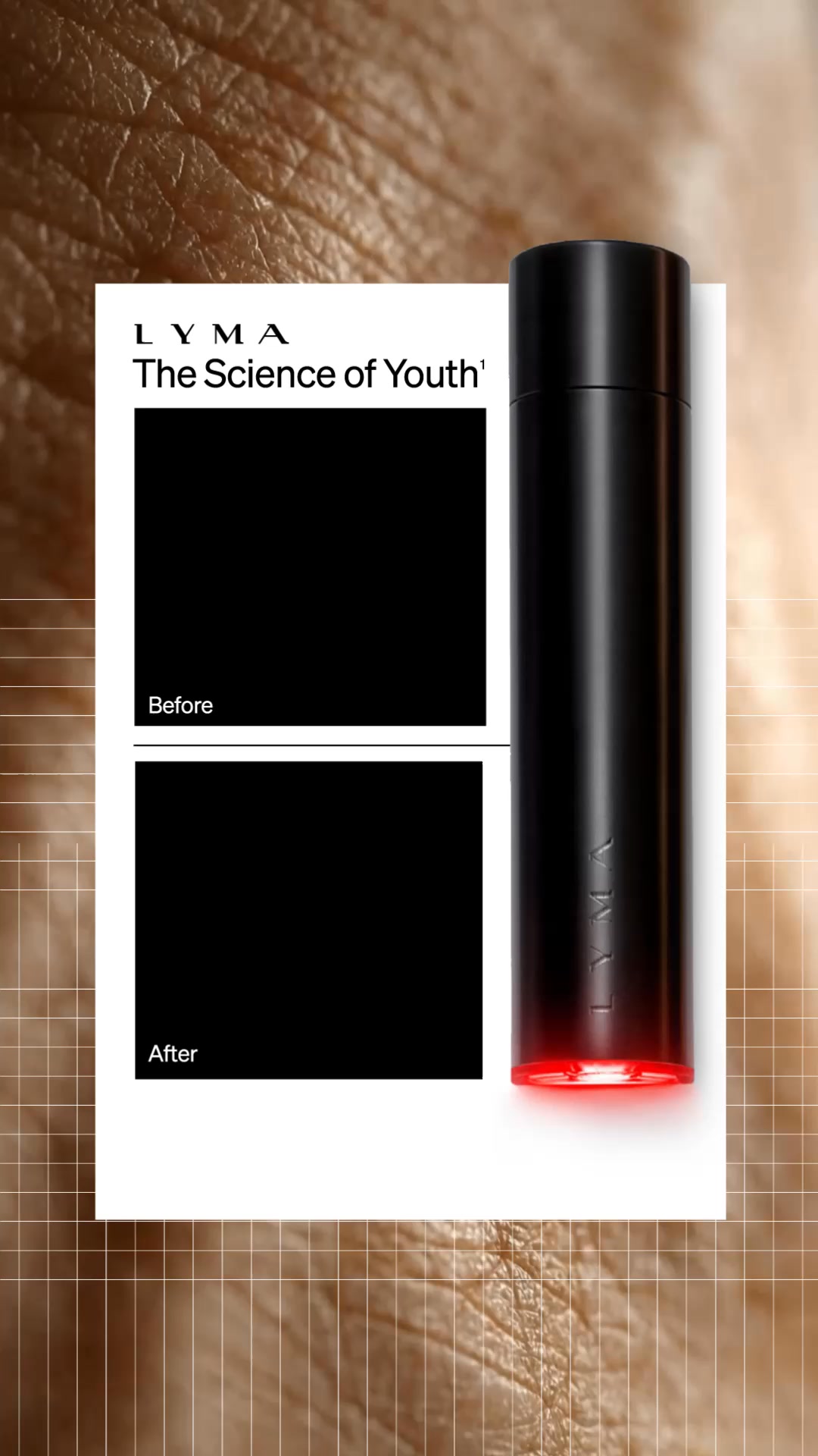 Precision Technology for the Neck