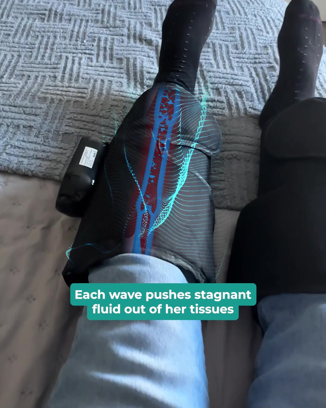 New Way Of Reducing Swollen Legs 👉