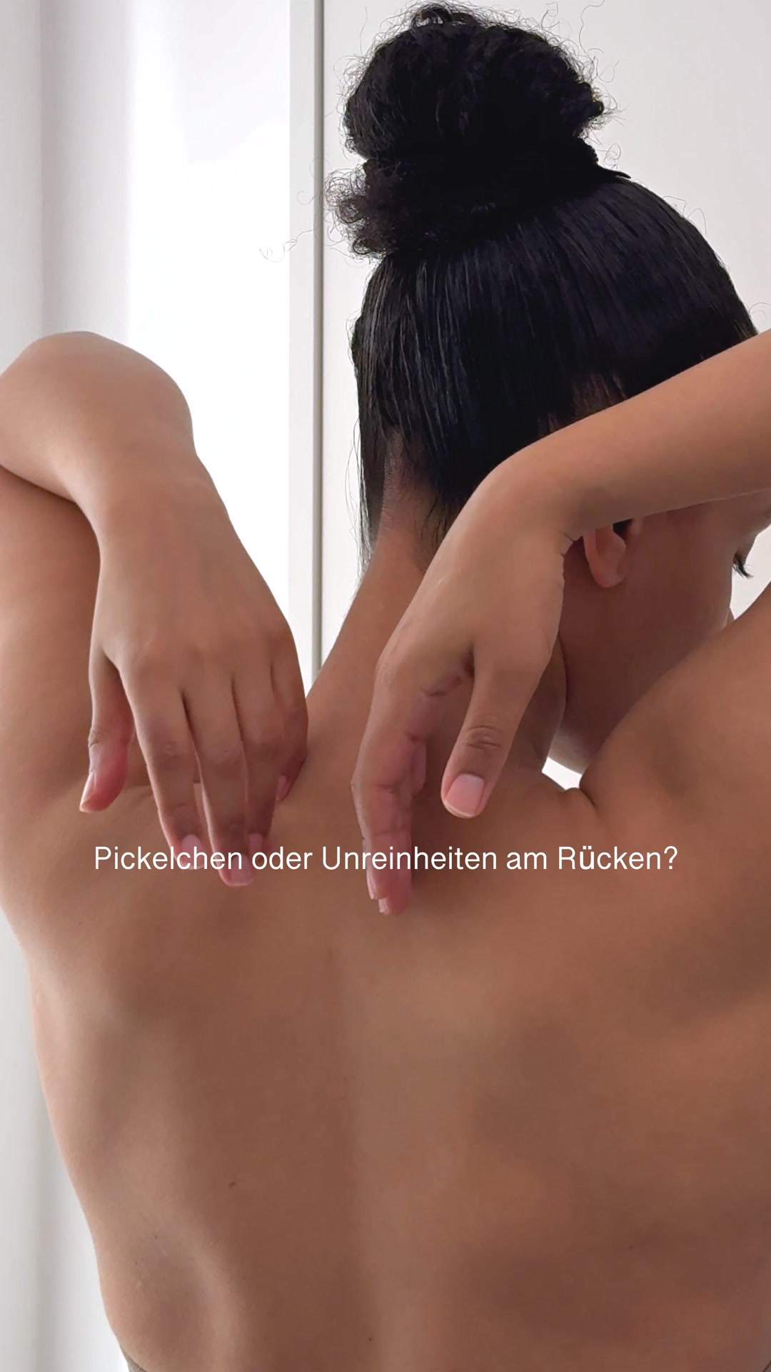 Das hilft bei Unreinheiten am Rücken