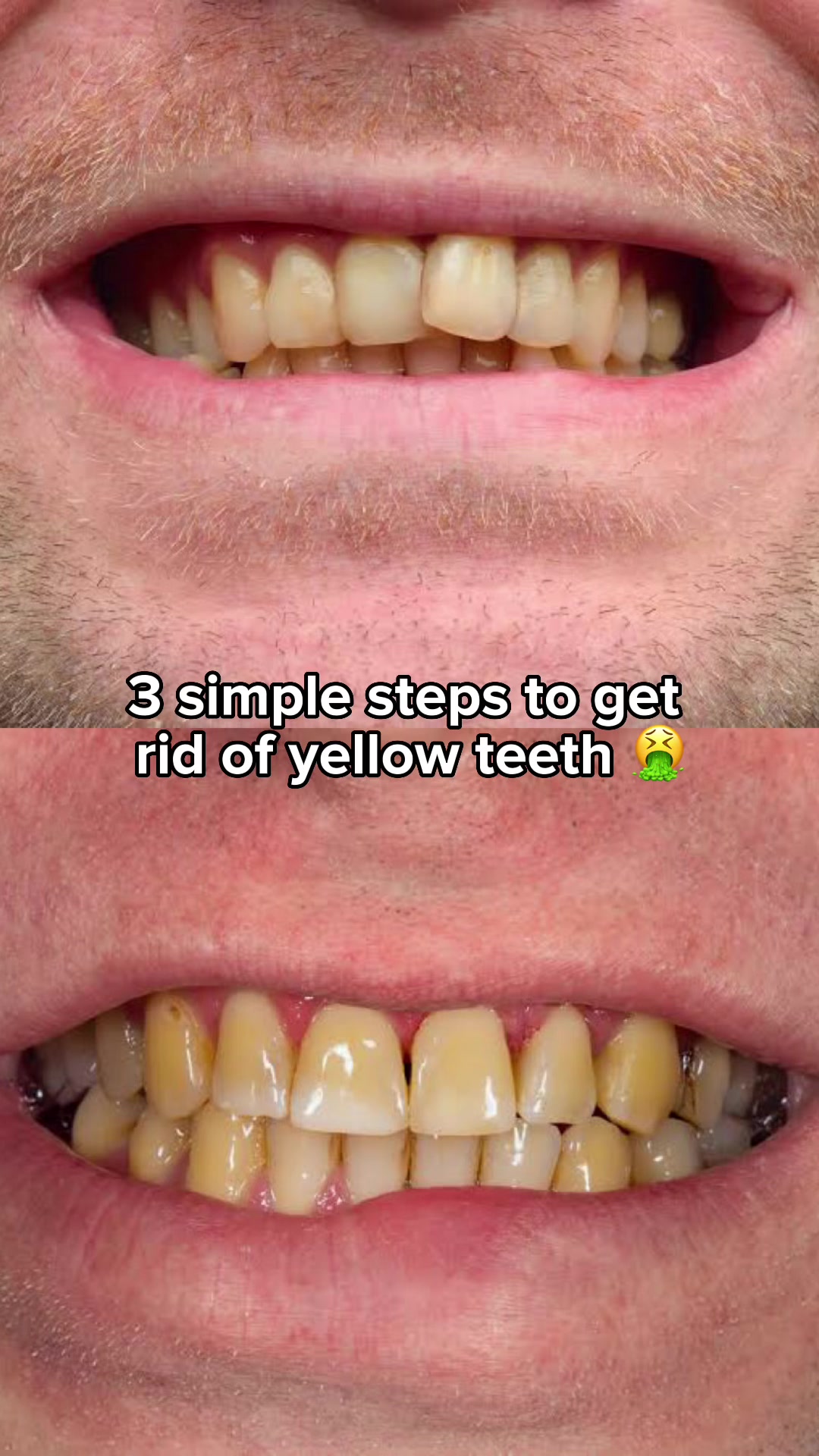 'The nation's favourite tooth whitener' - The Guardian 🇬🇧