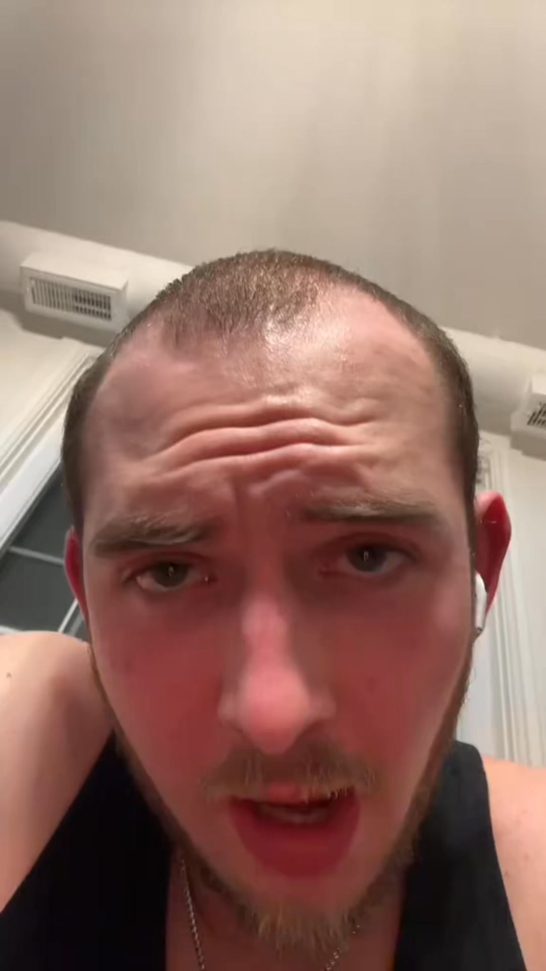 A Smarter Way to Treat Hair Loss