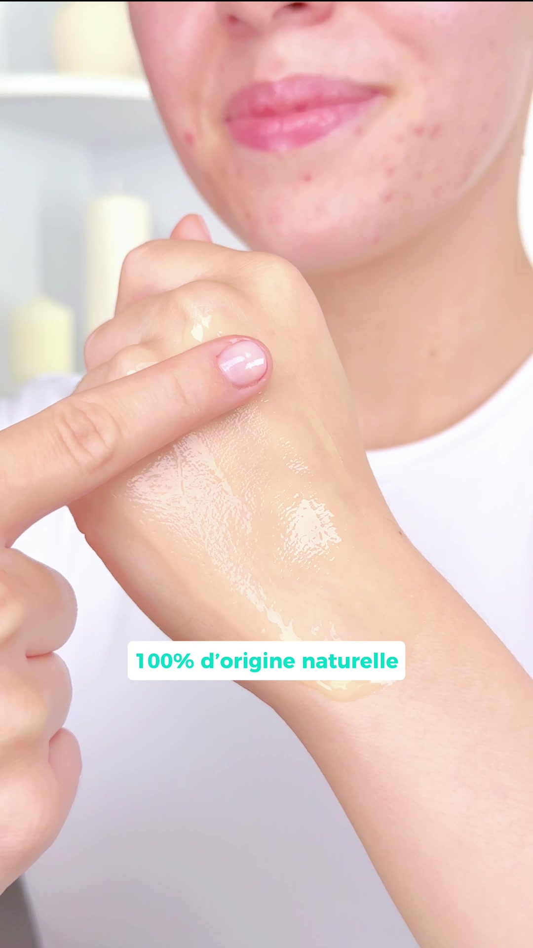 Enfin un sérum efficace contre l'acné 100% naturel !