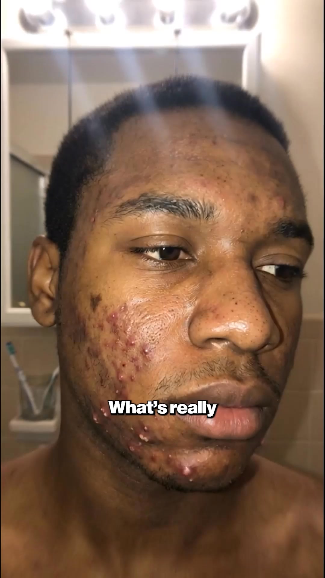 Bacteria lives DEEP in your face