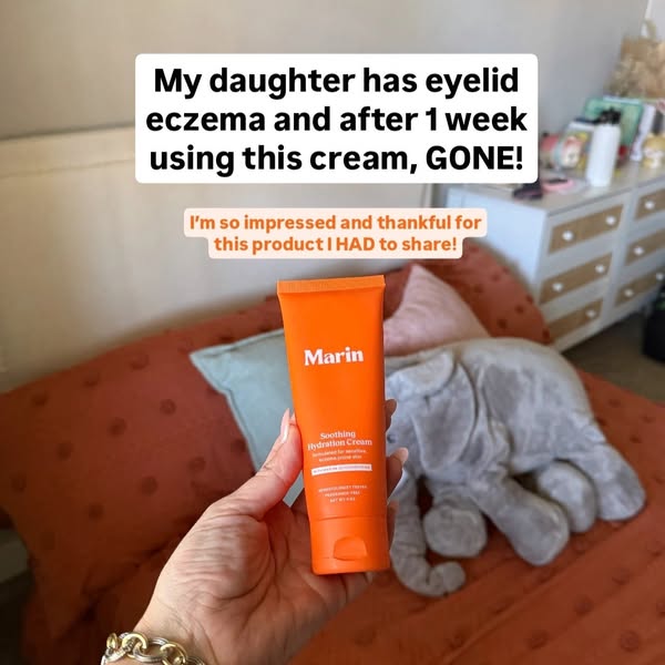 If you have eczema, you NEED this.