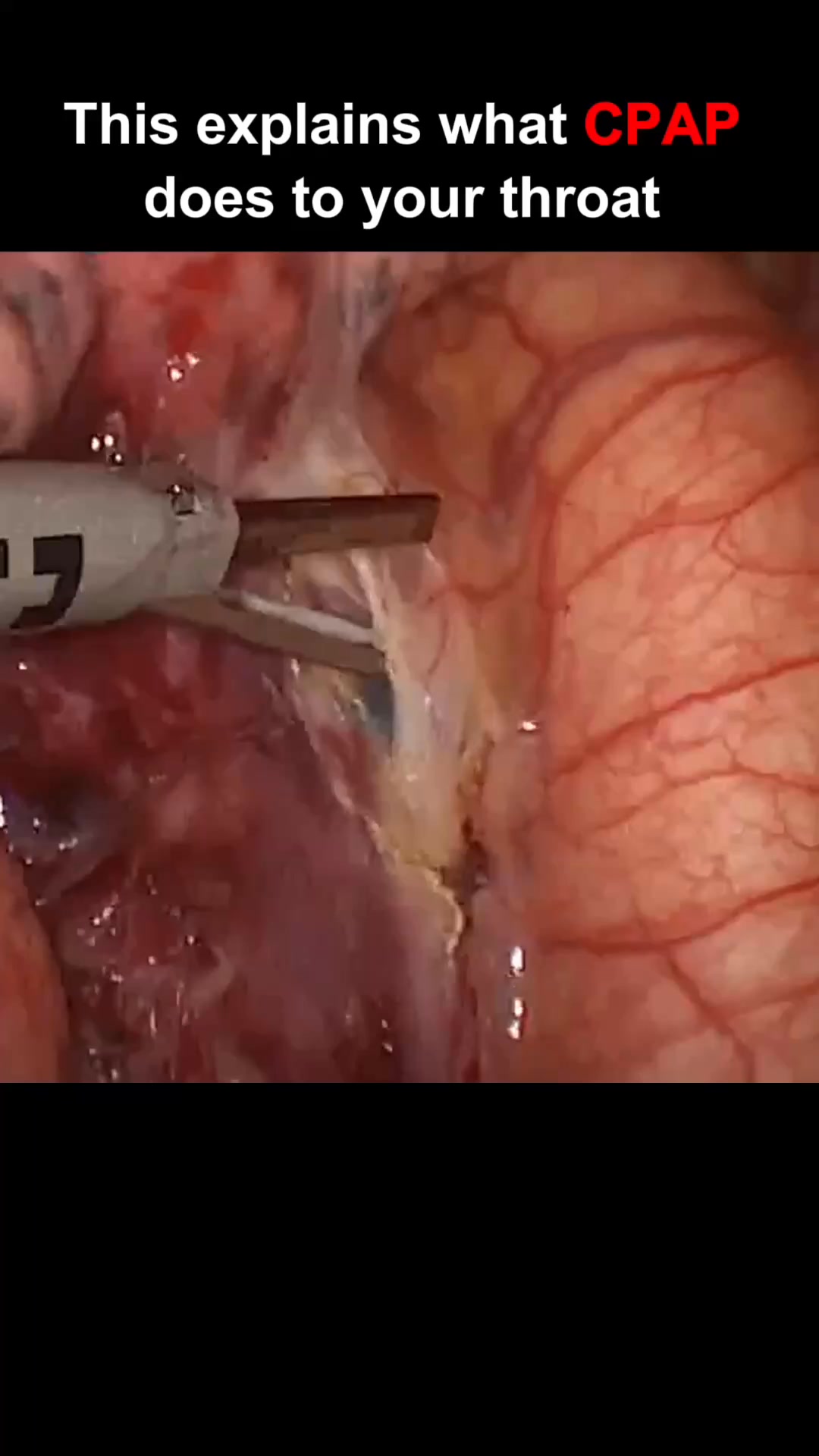 Snore No More, Sleep Better