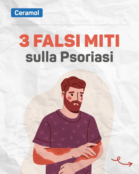❓Quante ne hai sentite sulla psoriasi?
“È contagiosa”
“È colpa dello stress”
“Con la crema giusta passa”
 
⚠️ Spoiler: sono tutti falsi miti.
Nel carosello di oggi li smontiamo uno per uno.
✨ L’informazione è il primo passo verso il rispetto.
📲 Scrivici nei commenti quale frase sbagliata ti sei sentito dire di più!
 
#Psoriasi #FalsiMiti #PelleSensibile #SkinTalk