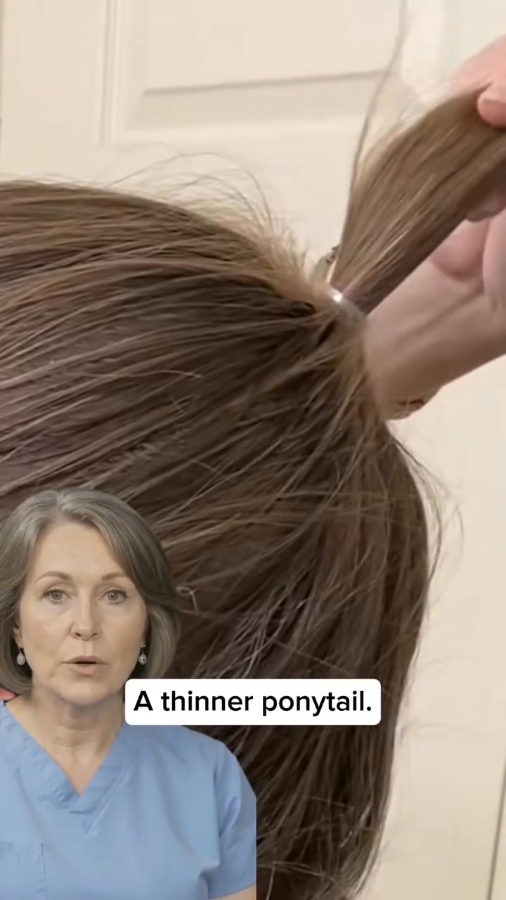 Hair loss due to GLP-1