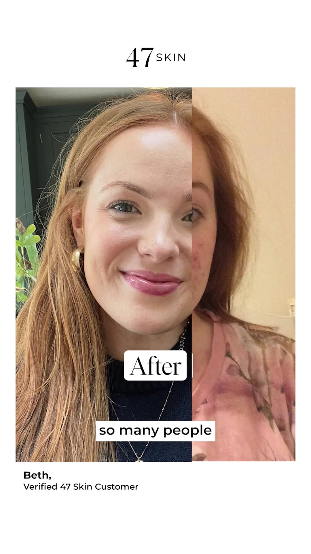 A skin treatment that actually works