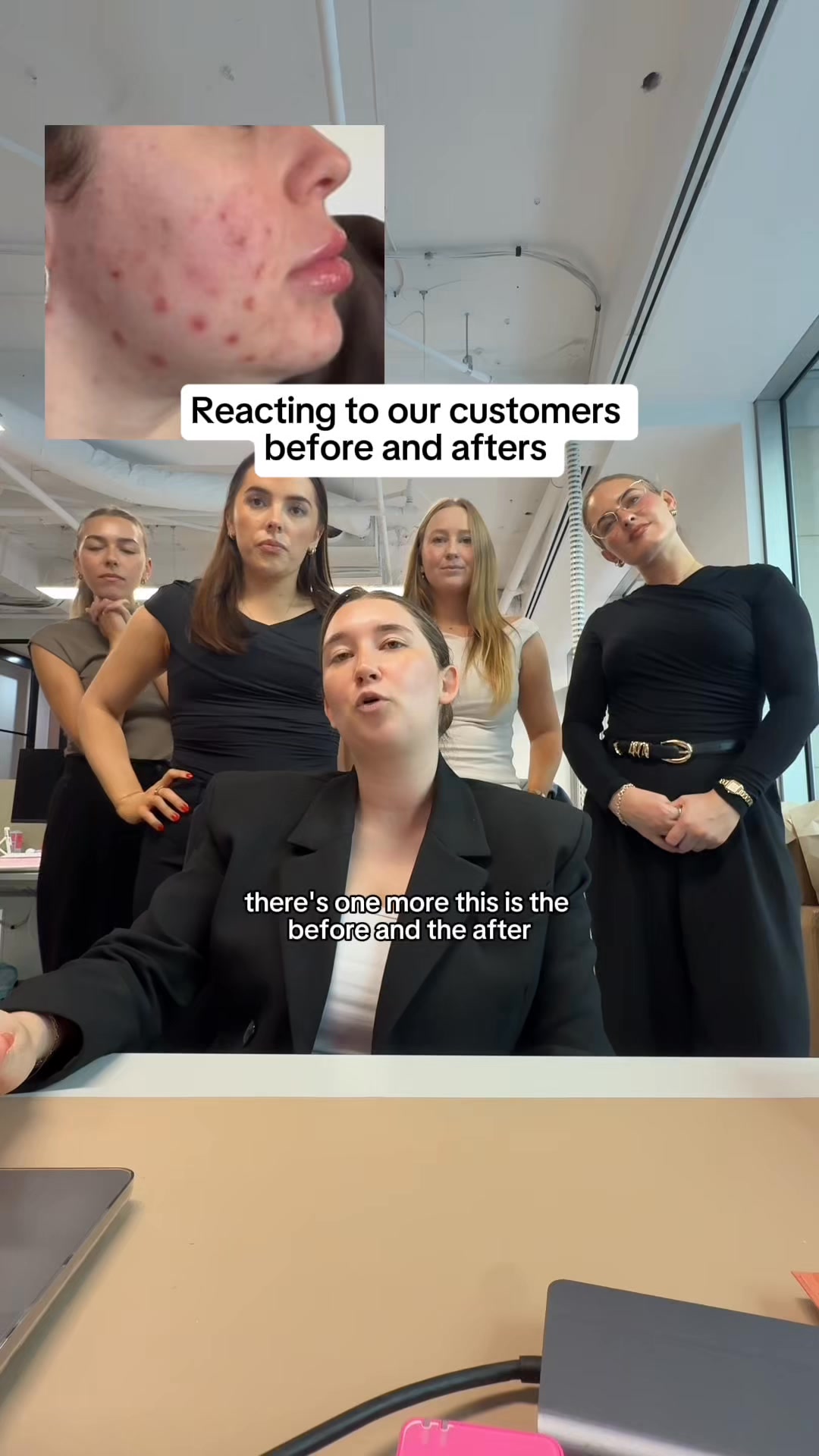 spot cream by the breakout hack