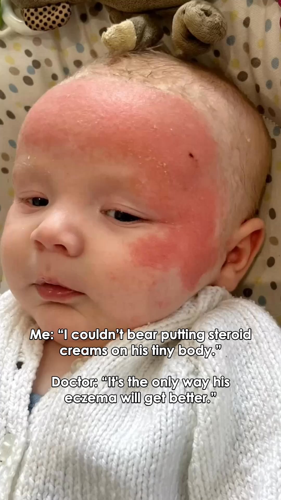 3 Steps to Skin Relief!