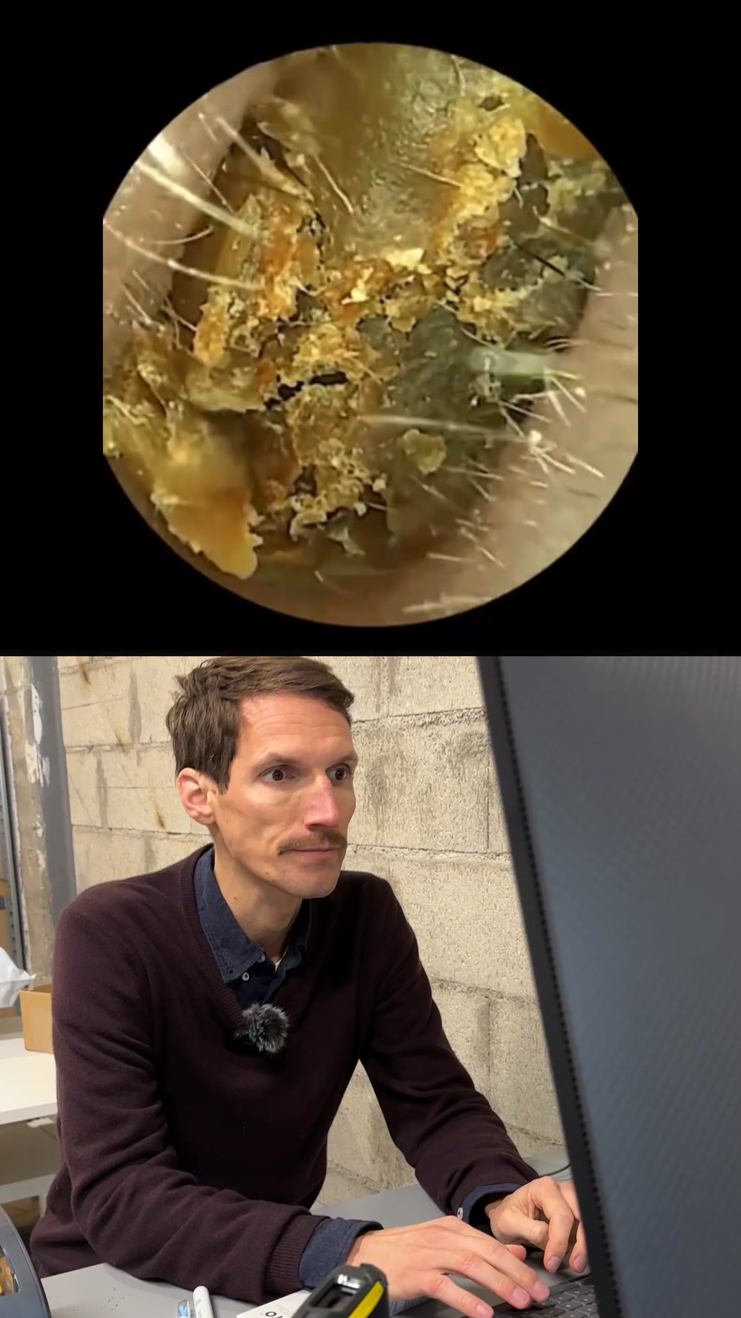 👀 Voyez ce qui se cache VRAIMENT dans vos oreilles